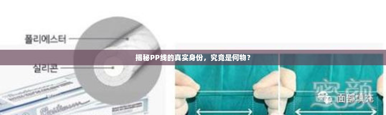 揭秘PP線的真實身份，究竟是何物？